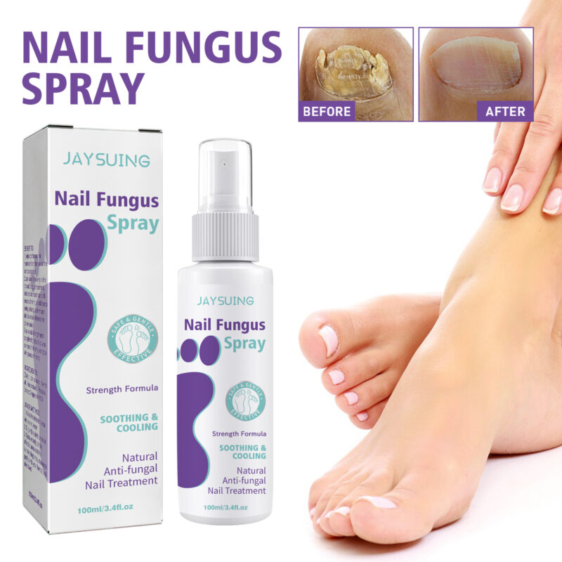 Yellowing and Thickening Nails