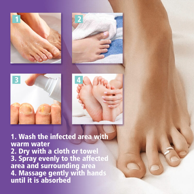 Natural Nail Care Spray for Ingrown, Yellowing & Thickening Nails - Image 6