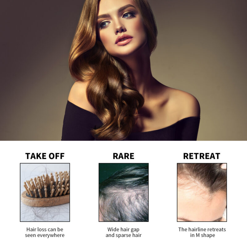 Plant-Based Scalp Oil Serum for Nourishing, Moisturizing & Healthy Hair Support - Image 3