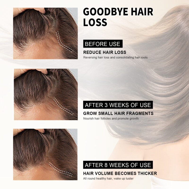 Plant-Based Scalp Oil Serum for Nourishing, Moisturizing & Healthy Hair Support - Image 4