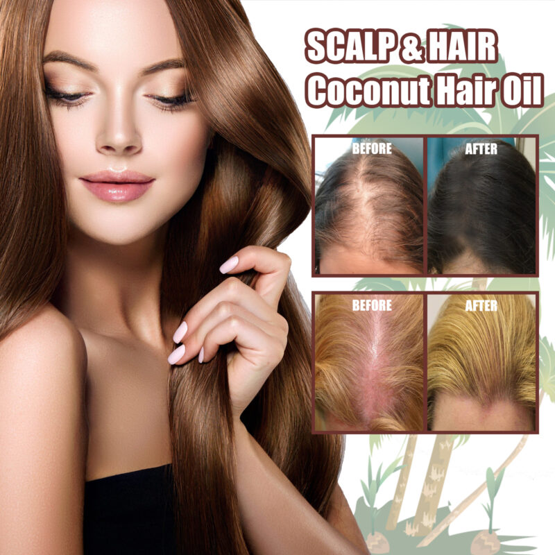 Coconut Hair Oil: Moisturize, Strengthen & Hydrate Scalp Care - Image 4