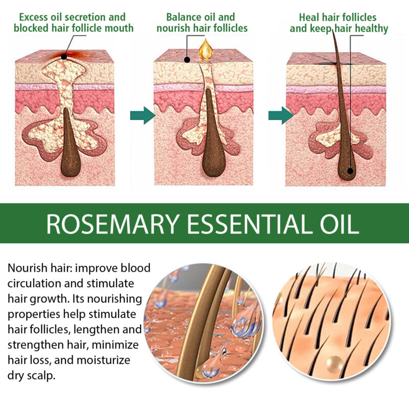 Rosemary Essential Oil for Hair Care & Skin Hydration - Plant-Based Nourishment - Image 4