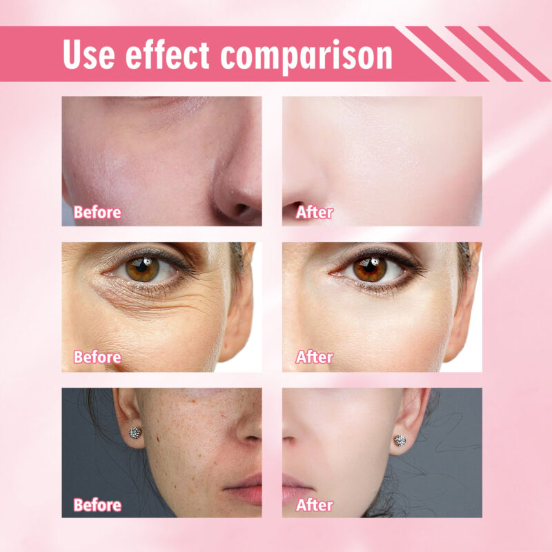 Whitening Serum - Moisturizes, Reduces Dark Spots & Brightens Skin - Image 3
