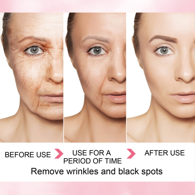 Whitening Serum - Moisturizes, Reduces Dark Spots & Brightens Skin - Image 4