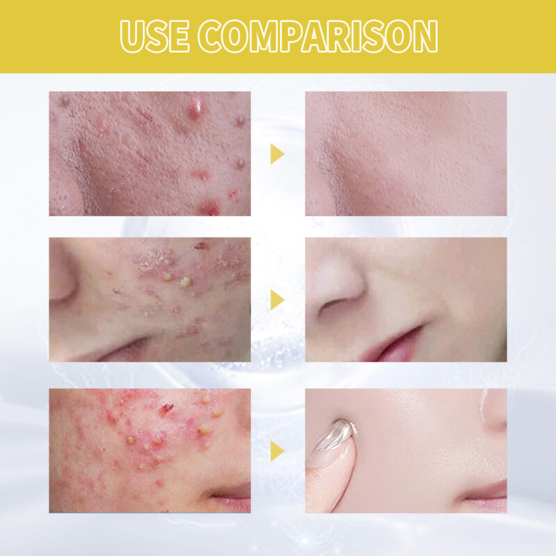 Natural Orchid Facial Essence: Pore-Clarifying Hydrating Formula - Image 3