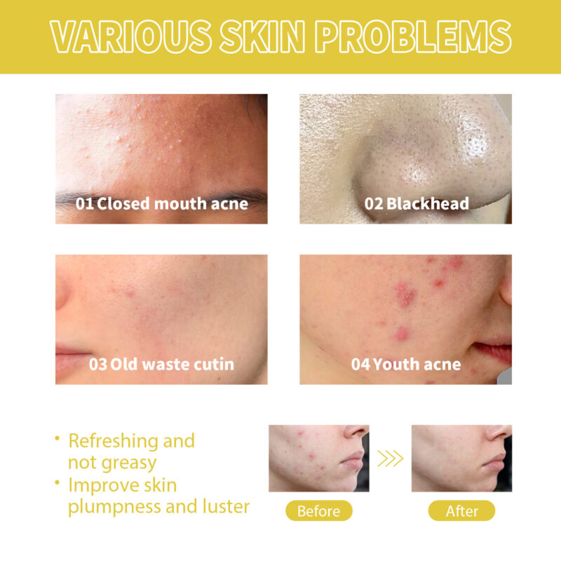 Natural Orchid Facial Essence: Pore-Clarifying Hydrating Formula - Image 4