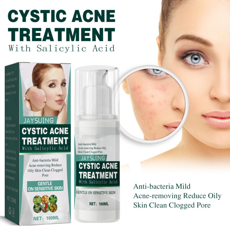 Cystic Acne Face Cream for Closed Pimples & Acne Marks with Natural Ingredients - Image 2