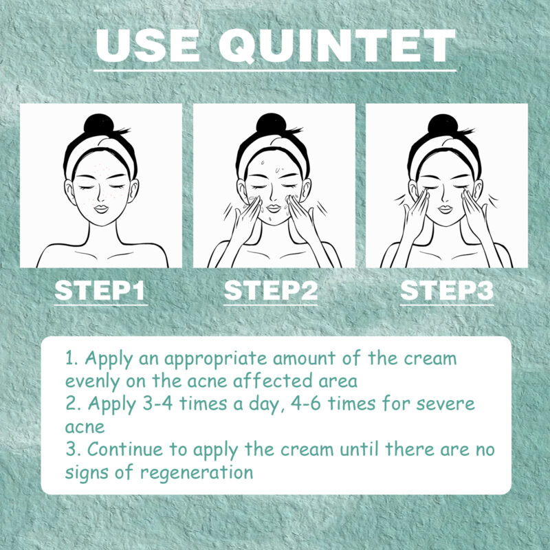 Cystic Acne Face Cream for Closed Pimples & Acne Marks with Natural Ingredients - Image 6