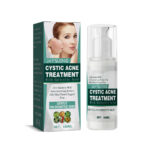 Cystic Acne Face Cream for Closed Pimples and Acne Marks with Natural Ingredients