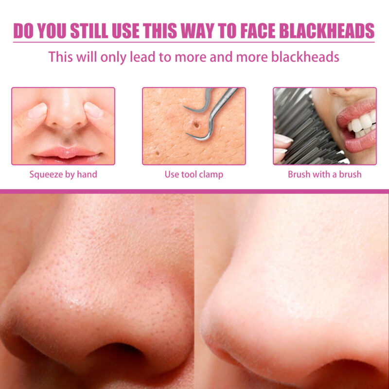 Aloe Vera Nose Patch Set - Blackhead Removal & Pore Cleansing - Image 4