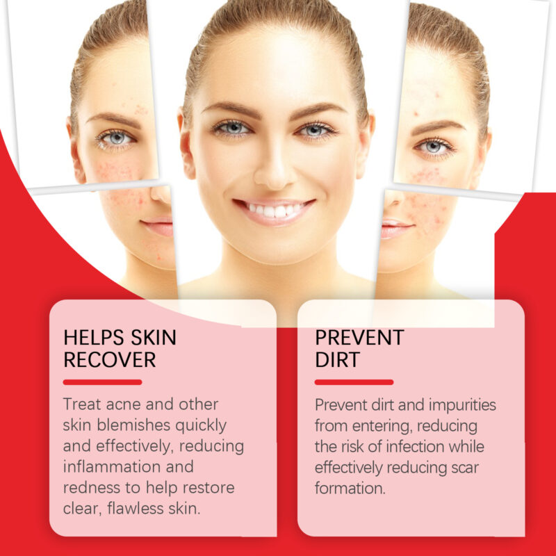 Acne Blemish Patch - Facial Care Patches for Blemish-Prone Skin - Image 3