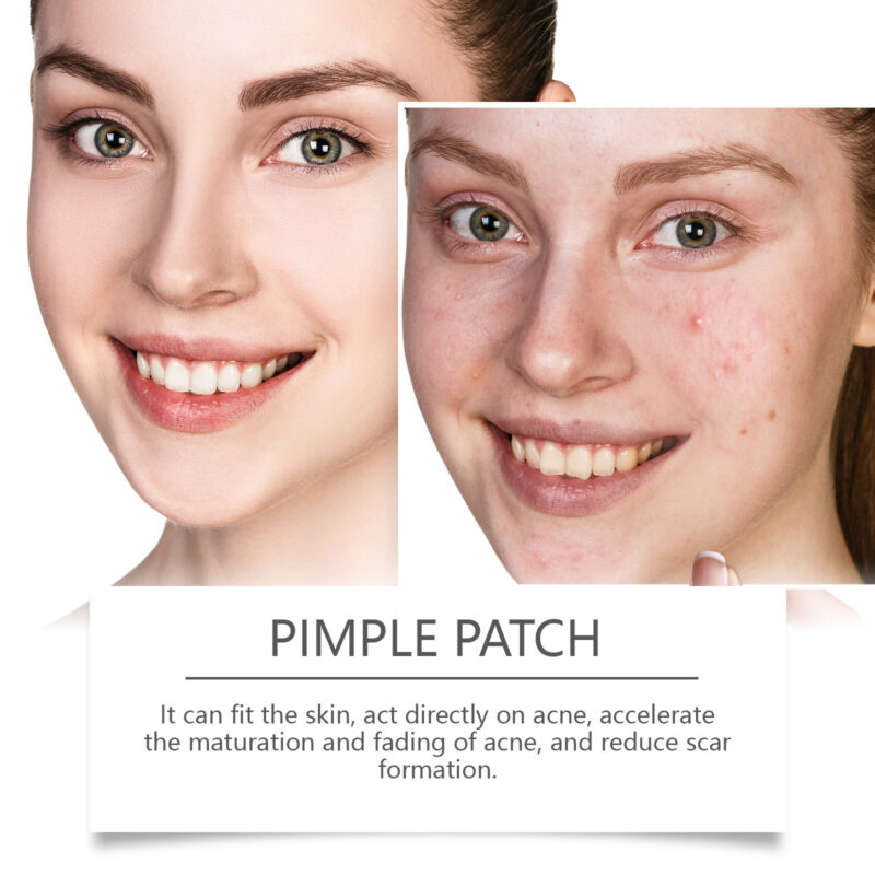 Hydrocolloid Acne Spot Patch - Daily Skin Care to Support Clearer Complexion - Image 3