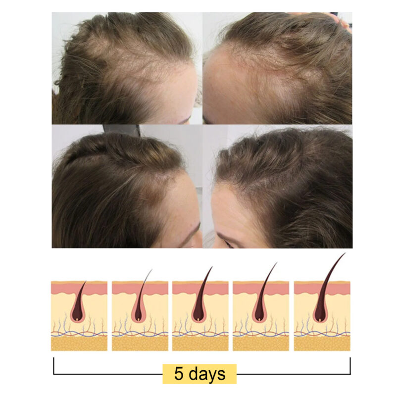 Ginger Hair Soap Bar - Moisturizing Scalp & Hair Care for Healthy Hair - Image 4