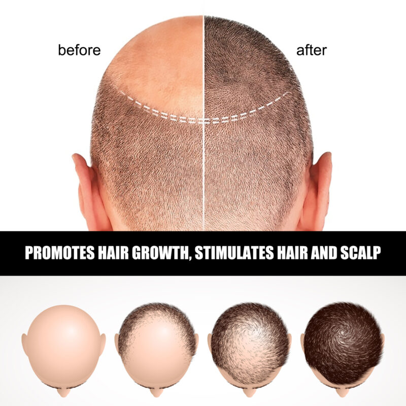 Hair Ampoule Serum - Volumizing, Moisturizing & Strengthening Daily Care - Image 3
