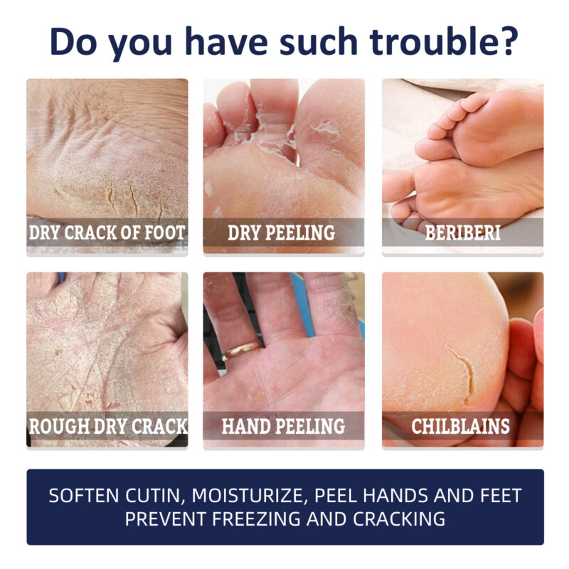 Hand & Foot Cream Hydrating Moisturizer with Natural Ingredients for Dry Cracked Skin Care - Image 3