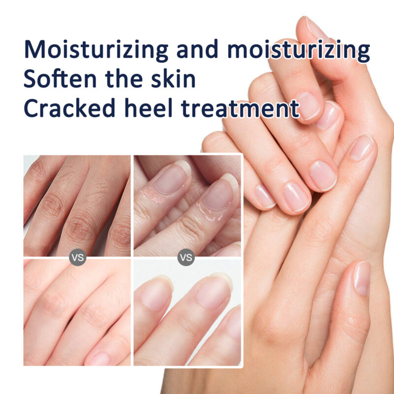 Hand & Foot Cream Hydrating Moisturizer with Natural Ingredients for Dry Cracked Skin Care - Image 4