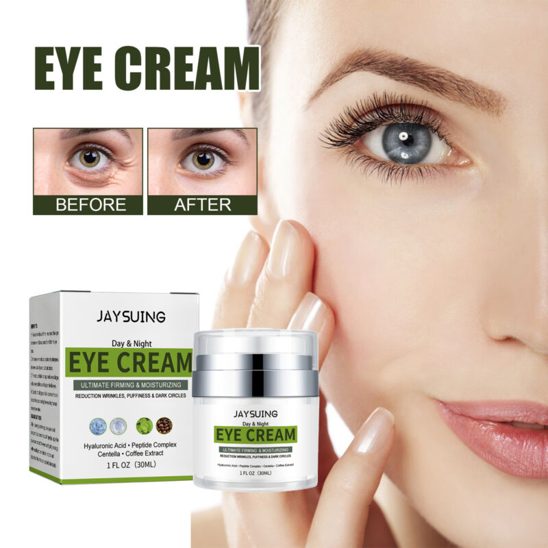 Fine Lines and Dark Circles