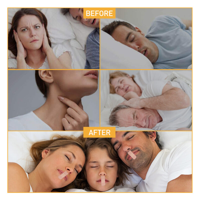 Anti-Snoring Patches: Reduce Snoring & Improve Sleep for Adults - Nighttime Use - Image 3