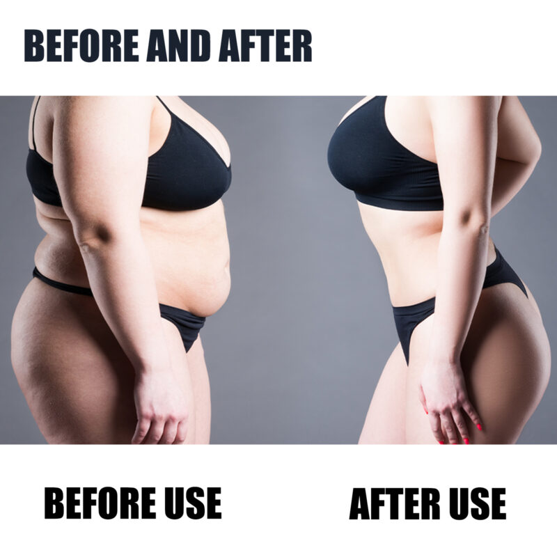 Natural Belly Button Patch for Body Contour Support - Thighs & Abdomen - Image 4