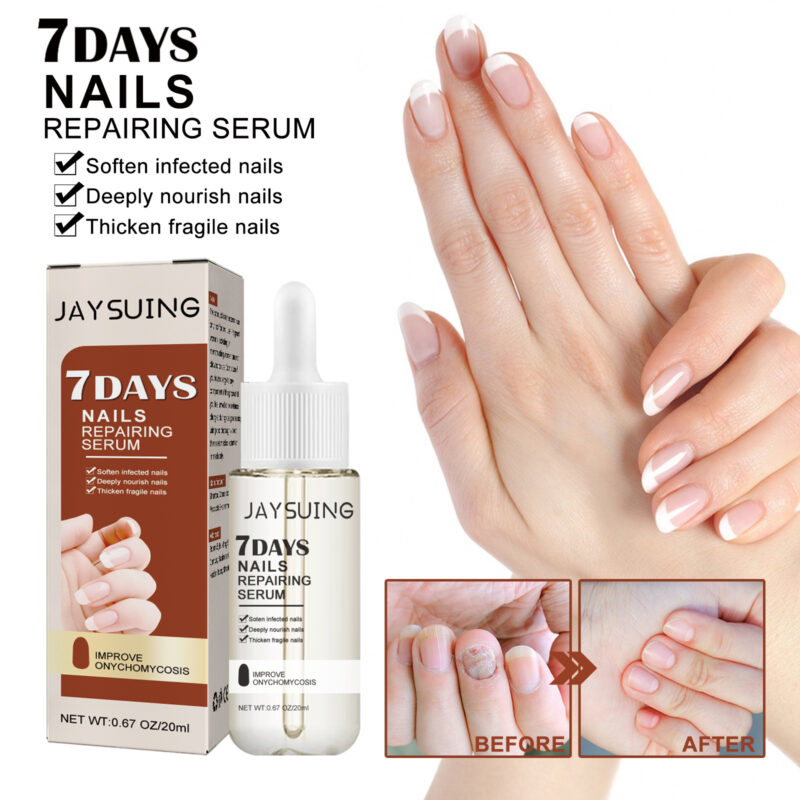 7-Day Nail Care Essence | Nourishing Hand & Foot Serum for Stronger Nails - Image 2