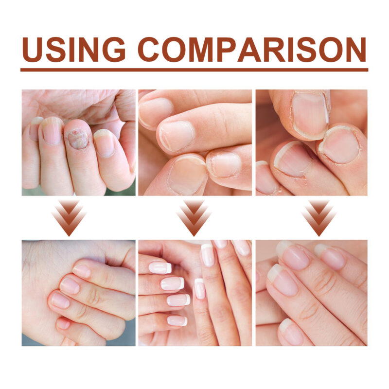 7-Day Nail Care Essence | Nourishing Hand & Foot Serum for Stronger Nails - Image 3