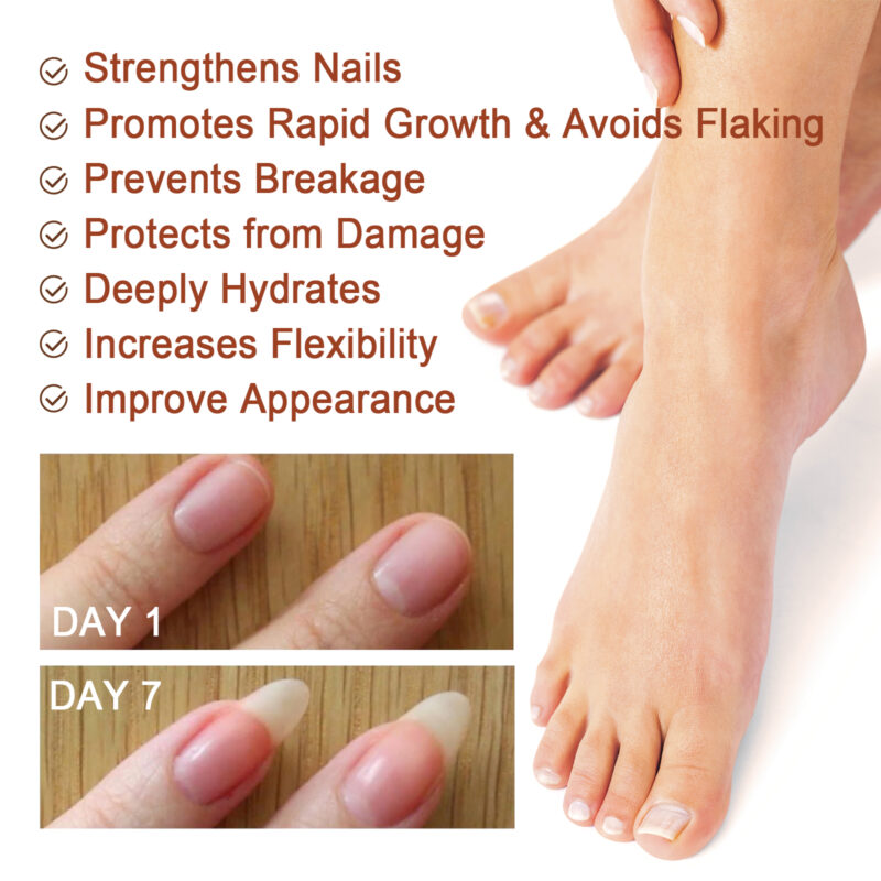 7-Day Nail Care Essence | Nourishing Hand & Foot Serum for Stronger Nails - Image 4