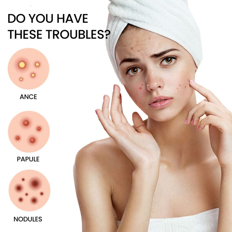 Hydrocolloid Pimple Patch - Blemish Cover, Redness Reduction, Skin Repair - Image 3