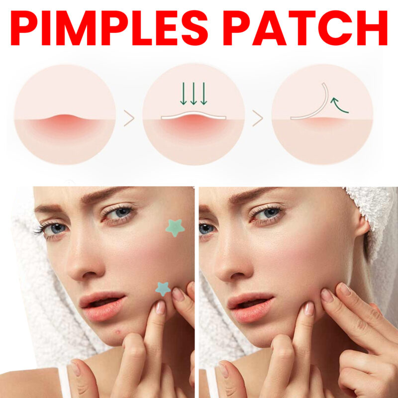 Hydrocolloid Pimple Patch - Blemish Cover, Redness Reduction, Skin Repair - Image 4