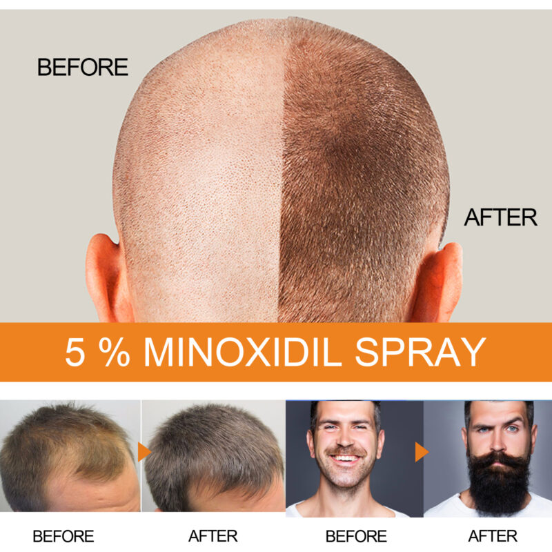 Men's Hair & Beard Nourishing Strengthening Spray - Image 4