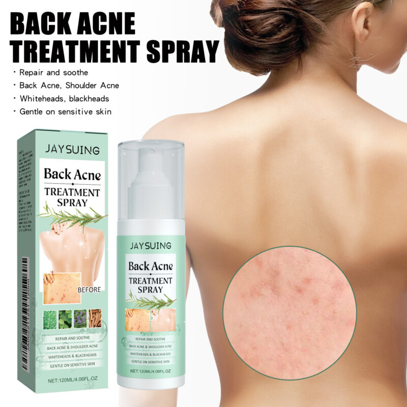 Back Acne Spray for Body - Hydrating Treatment to Balance Skin - Image 2