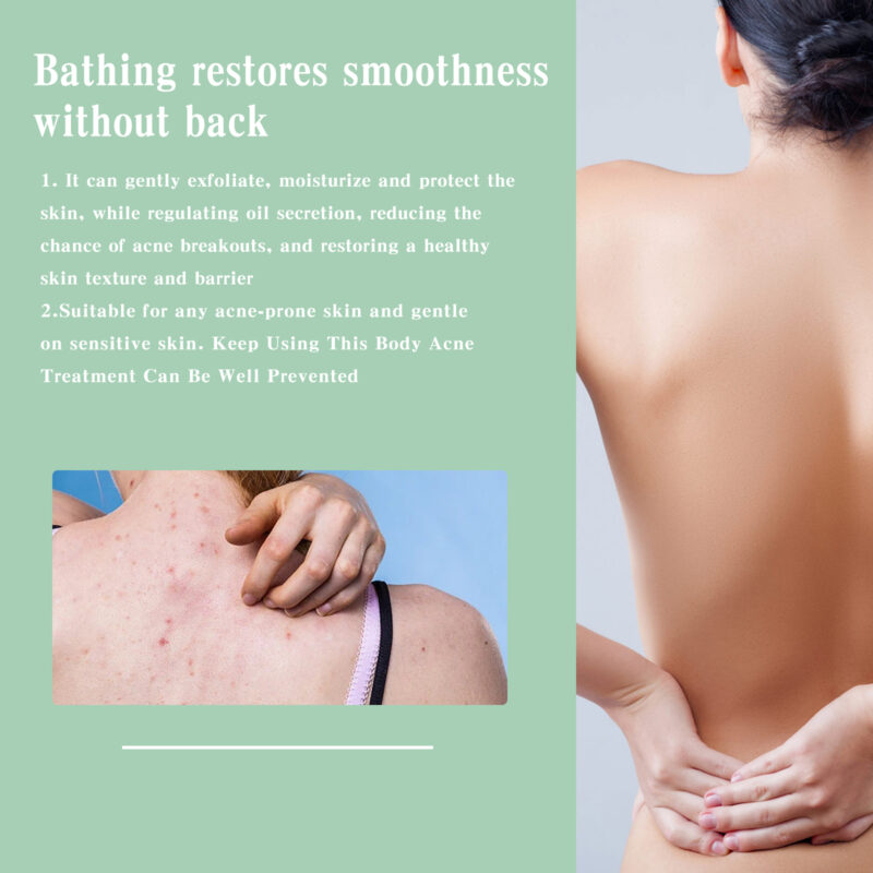 Back Acne Spray for Body - Hydrating Treatment to Balance Skin - Image 3