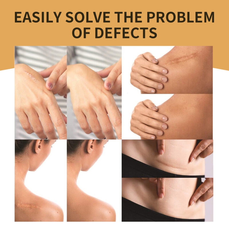 Invisible Concealer for Tattoos Scars Spots Waterproof Cover - Image 4