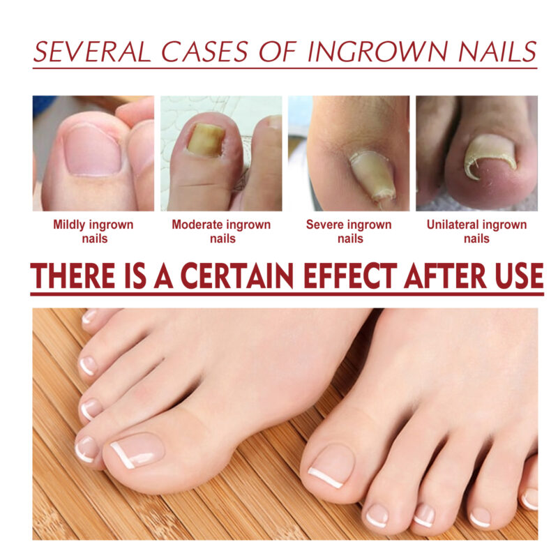 Natural Nail Care Oil - Softening & Brightening for Healthy Nails - Image 3