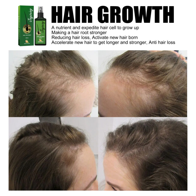 Gentle Scalp Nourishing Hair Spray, Moisturizes Softens Hair, Scalp Massage - Image 3