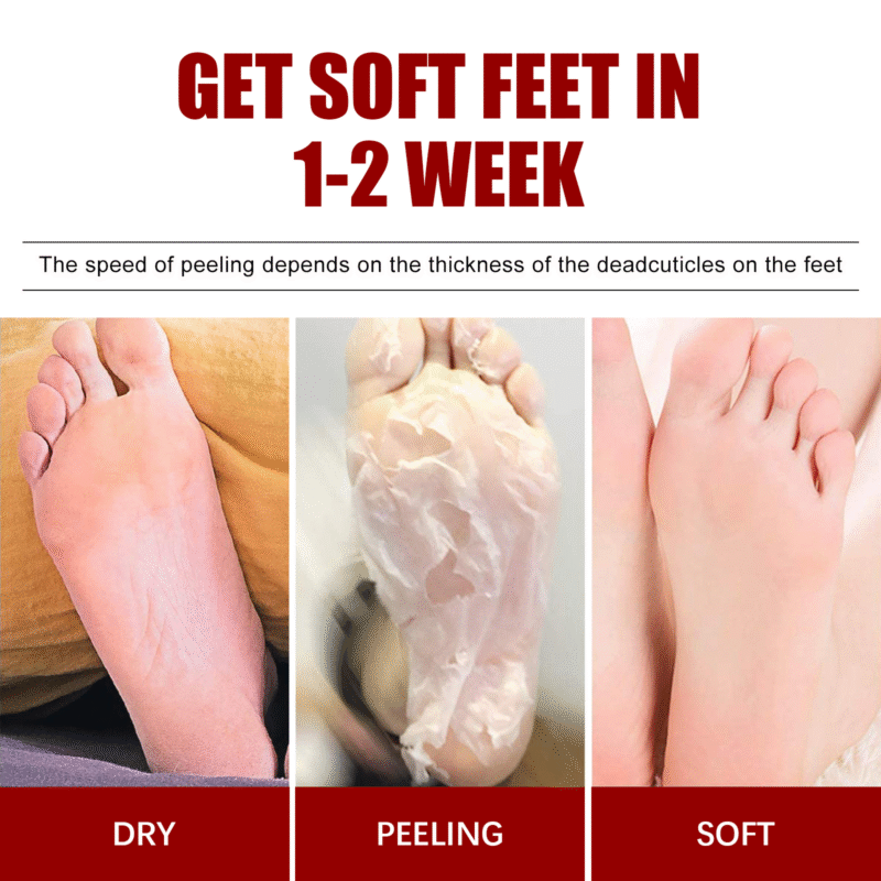 Exfoliating Foot Mask for Softening Calluses & Dead Skin Removal - Image 3