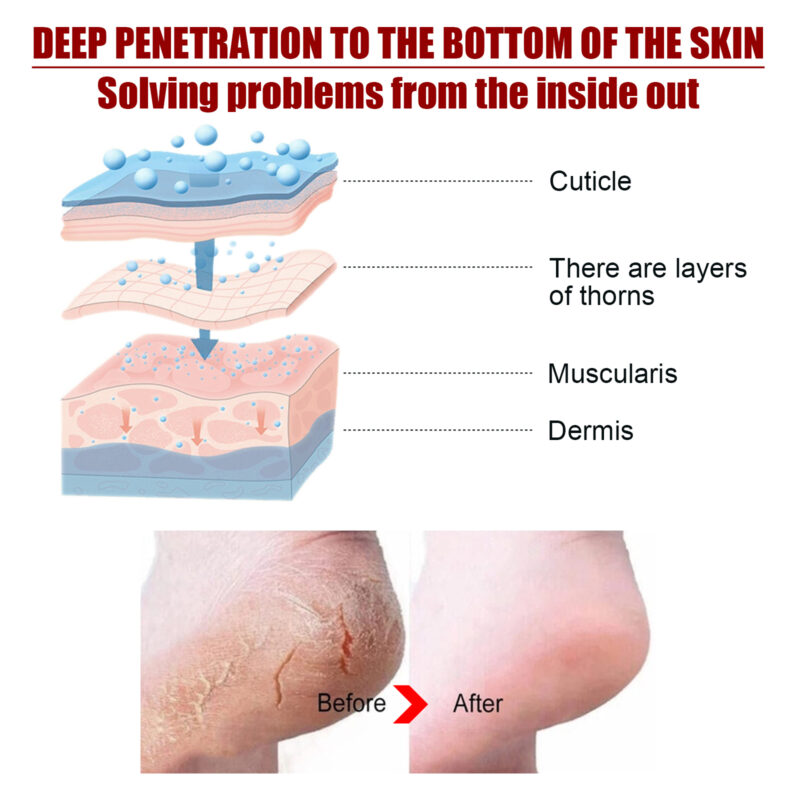 Exfoliating Foot Mask for Softening Calluses & Dead Skin Removal - Image 4