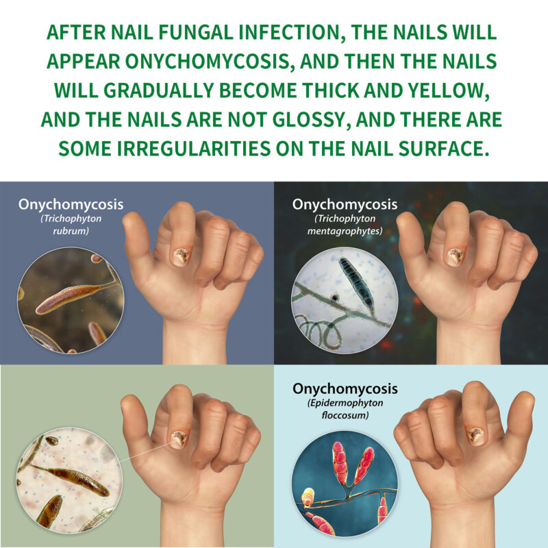 Ginger Nail Care Moisturizer for Soft Shine | Hand & Foot Treatment - Image 3