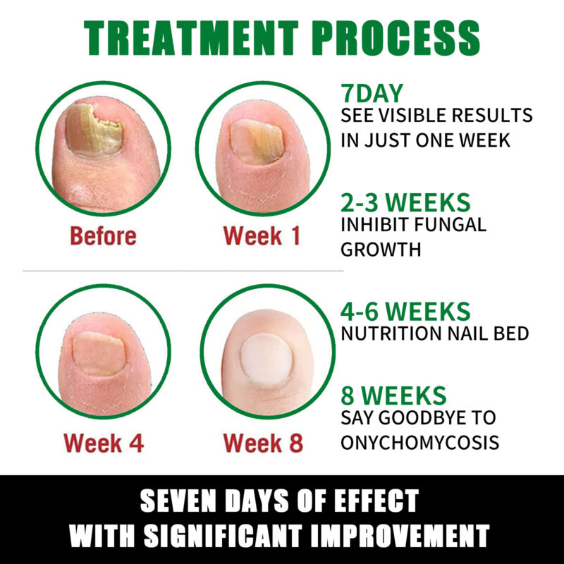 Ginger Nail Care Moisturizer for Soft Shine | Hand & Foot Treatment - Image 5