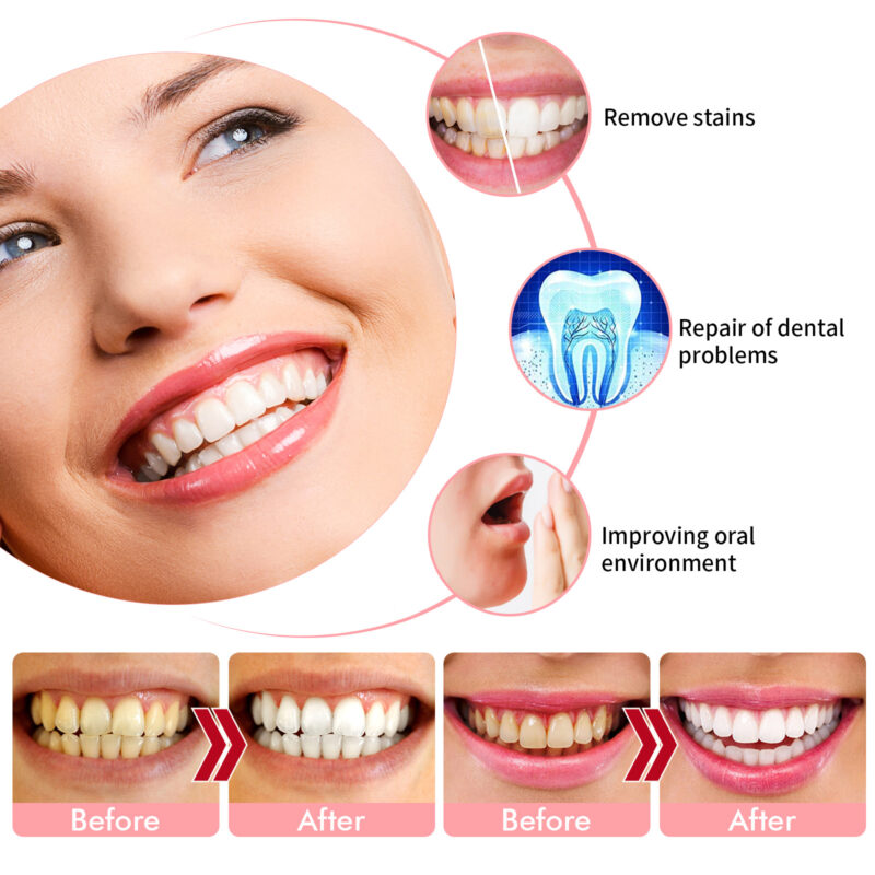 Baking Soda Toothpaste with Passion Fruit & Blueberry - Gentle Daily Clean - Image 3