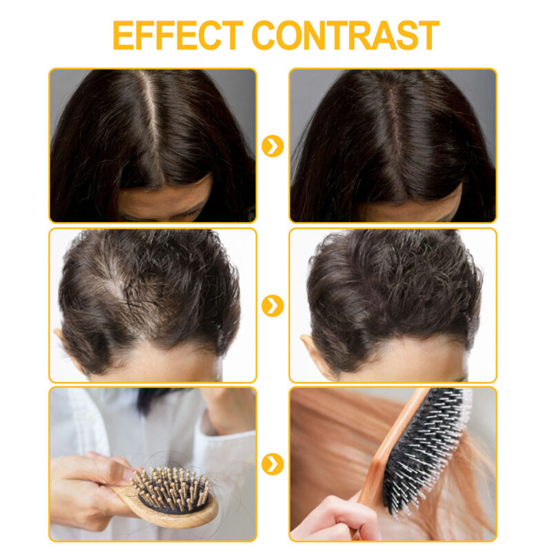 Hair Ball Massage Solution - Scalp Care & Hair Thickening Support - Image 3