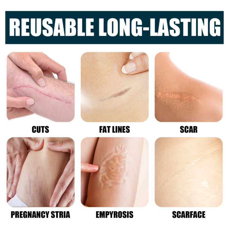 Body Cream Gel - Gentle Moisturizing for Smooth Skin, Daily Nourishing Care - Image 4