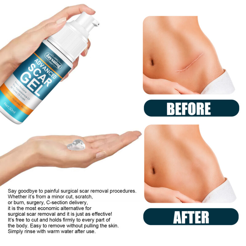 Body Cream Gel - Gentle Moisturizing for Smooth Skin, Daily Nourishing Care - Image 5