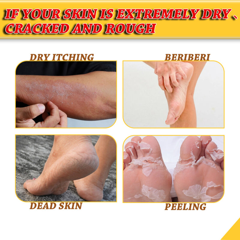 Foot Repair Cream for Dry, Itchy Feet - Moisturizing Treatment to Help Reduce Cracking - Image 3