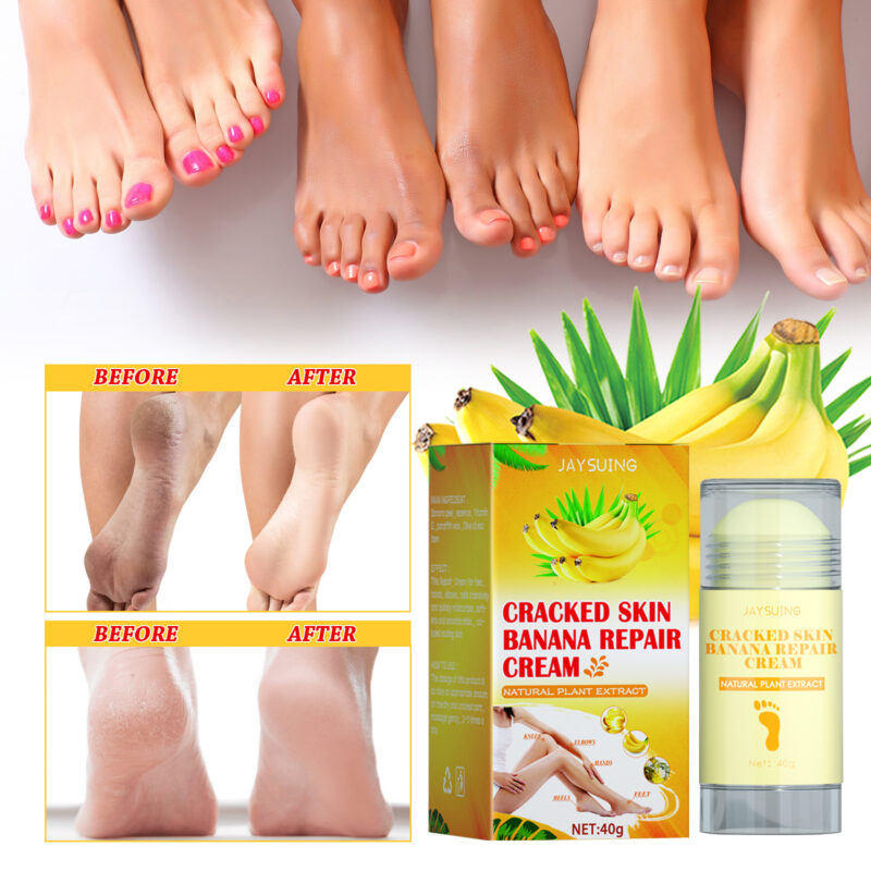 Foot Repair Cream for Dry, Itchy Feet - Moisturizing Treatment to Help Reduce Cracking - Image 4