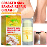 Foot Repair Cream for Dry Itchy Feet Moisturizing Treatment to Reduce Cracking
