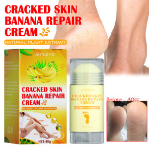 Foot Repair Cream for Dry Itchy Feet Moisturizing Treatment to Reduce Cracking