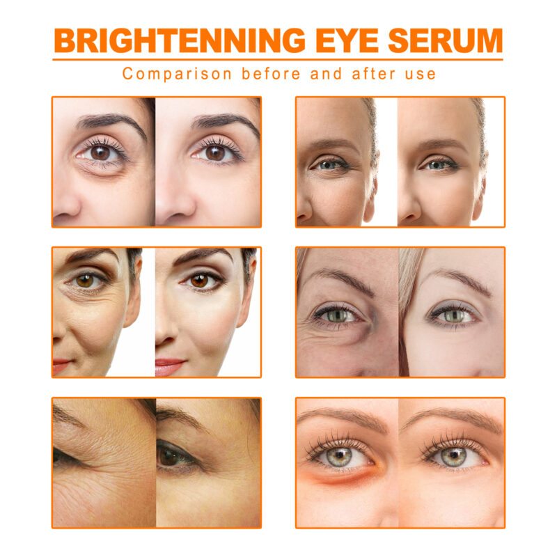Vitamin C Firming Eye Cream for Dark Circles, Puffiness & Hydration - Image 3
