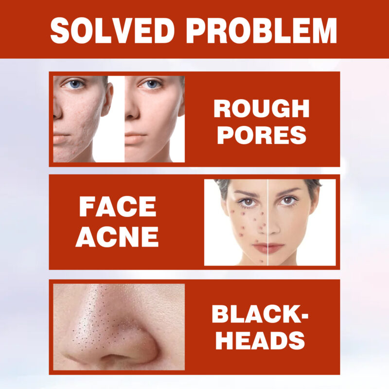 Pore Minimizer Serum - Brightening, Moisturizing & Deep Clean Formula with Natural Ingredients - Image 3