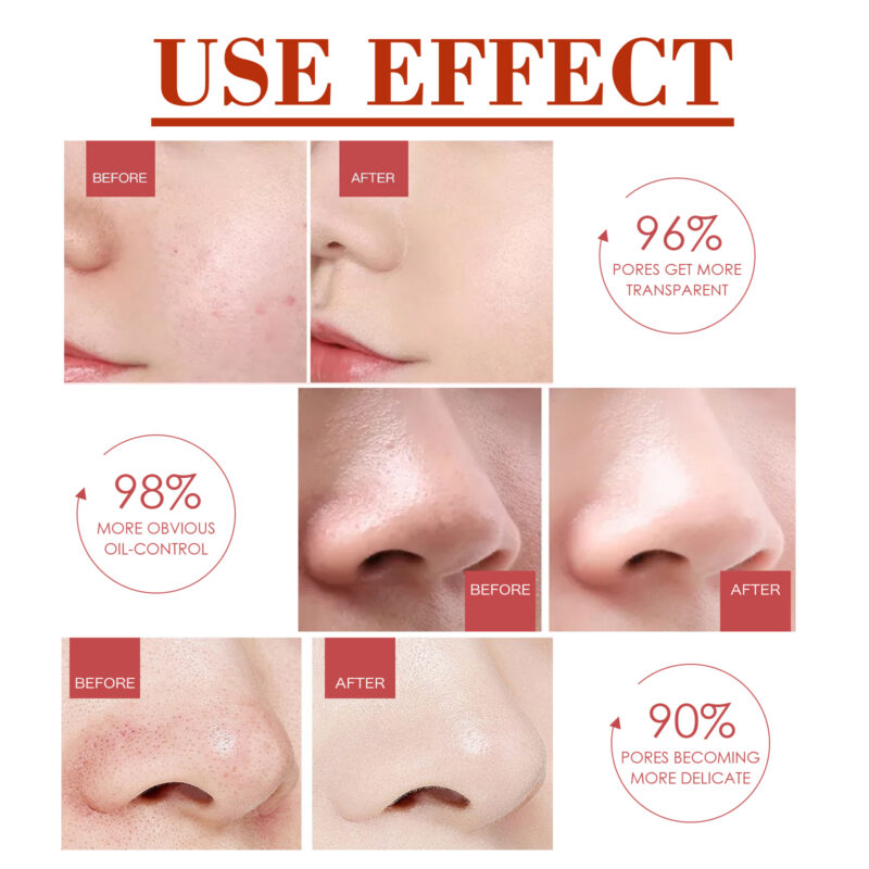Pore Minimizer Serum - Brightening, Moisturizing & Deep Clean Formula with Natural Ingredients - Image 4