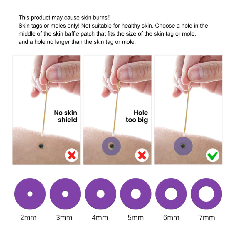 Wart & Skin Tag Removal Kit with Natural Plant-Based Lotion - Image 6